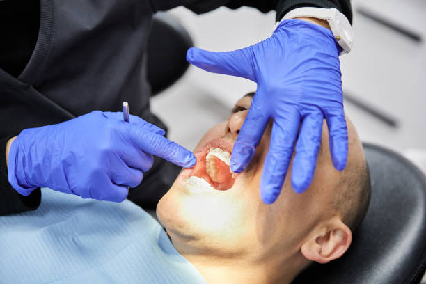 Best Emergency Tooth Extraction in Gibson City, IL