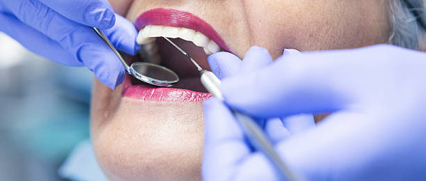 Best Emergency Dental Surgery in Gibson City, IL